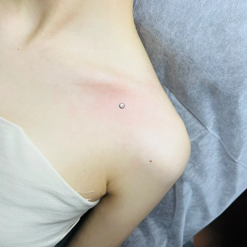 Piercing de superfície de aço  - Body Jewelry Dermal avaliação e preço